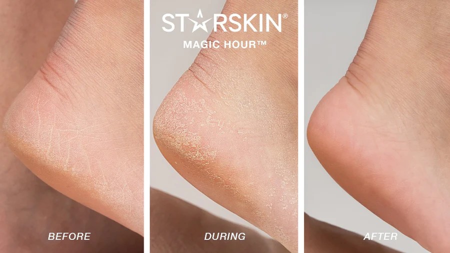 Starskin - Magic Hour™ - Fußpeeling